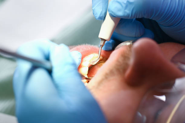 Best Emergency Treatment for Toothache in Mcgregor, TX